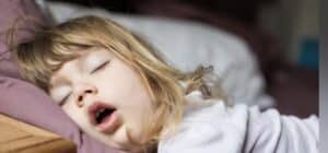 Children and Sleep Apnea